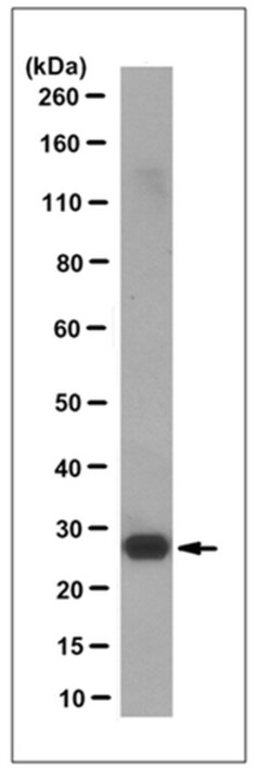 MilliporeSigma Mouse anti-NQO2, Clone: 4A4.1, 100&mu;g:Antibodies, Monoclonal